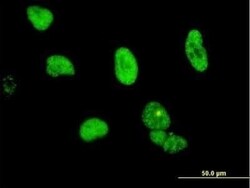CPSF6 Antibody (3F11), Novus Biologicals 0.1 mg | Buy Online | Novus Biologicals | Fisher Scientific