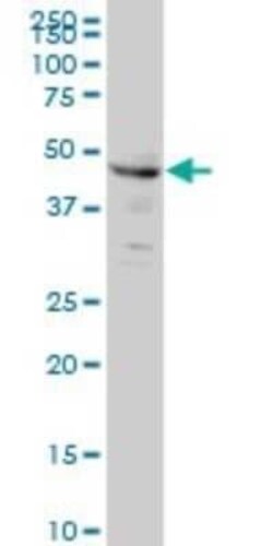 CPSF6 Antibody (3F11), Novus Biologicals 0.1 mg | Buy Online | Novus Biologicals | Fisher Scientific