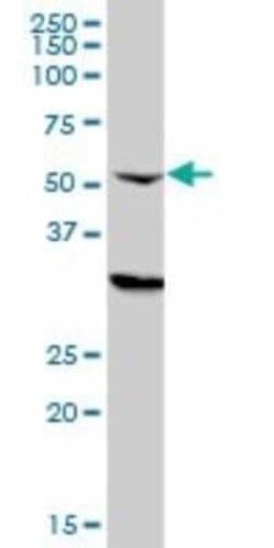 CPSF6 Antibody (3F11), Novus Biologicals 0.1 mg | Buy Online | Novus Biologicals | Fisher Scientific