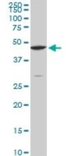 CPSF6 Antibody (3F11), Novus Biologicals 0.1 mg | Buy Online | Novus Biologicals | Fisher Scientific