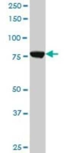 CPSF73 Antibody (1H8), Novus Biologicals 0.1 mg | Buy Online | Novus Biologicals | Fisher Scientific
