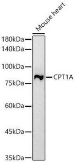 CPT1A Rabbit anti-Human, Mouse, Rat, Clone: 3M6E9, Novus Biologicals 20 &mu;g | Buy Online | Novus Biologicals | Fisher Scientific
