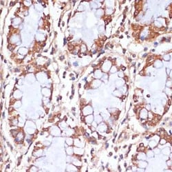 CPT1B Antibody - BSA Free, Novus Biologicals:Antibodies:Primary Antibodies
