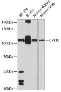 CPT1B Antibody - BSA Free, Novus Biologicals:Antibodies:Primary Antibodies