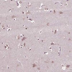 CPT1C Antibody, Novus Biologicals 25ul; Unconjugated:Antibodies, Polyclonal