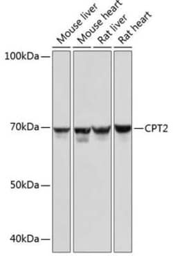 CPT2 Rabbit anti-Human, Mouse, Rat, Clone: 9V6M9, Novus Biologicals:Antibodies:Primary