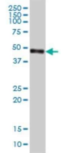 CPVL Antibody (2G5-1C1), Novus Biologicals 0.1 mg, Unconjugated:Antibodies,