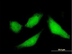 CPXCR1 Antibody, Novus Biologicals 0.05 mg, Unconjugated:Antibodies, Polyclonal