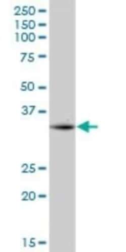 CPXCR1 Antibody, Novus Biologicals 0.05 mg, Unconjugated:Antibodies, Polyclonal