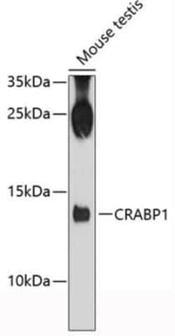 CRABP1 Antibody - Azide and BSA Free, Novus Biologicals:Antibodies:Primary