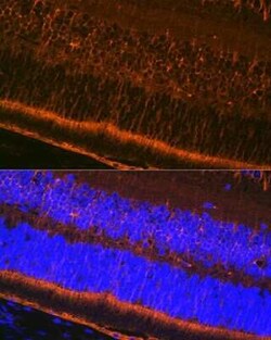 CRALBP Rabbit anti-Human, Mouse, Rat, Clone: 2M0G2, Novus Biologicals 100