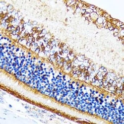 CRALBP Rabbit anti-Human, Mouse, Rat, Clone: 2M0G2, Novus Biologicals 100