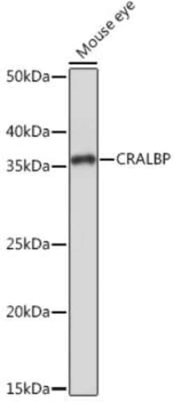 CRALBP Rabbit anti-Human, Mouse, Rat, Clone: 2M0G2, Novus Biologicals 100