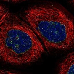 CRAT Antibody, Novus Biologicals 0.1 mL | Buy Online | Novus Biologicals | Fisher Scientific