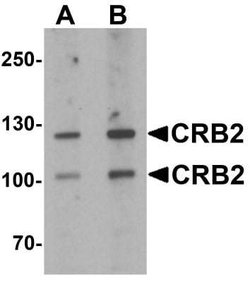 CRB2 Antibody - BSA Free, Novus Biologicals 0.1 mg | Buy Online | Novus Biologicals | Fisher Scientific