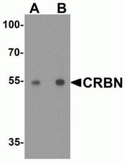 CRBN Antibody - BSA Free, Novus Biologicals 0.1 mg | Buy Online | Novus Biologicals | Fisher Scientific