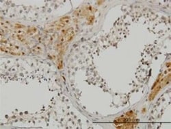 CREB3 Antibody (3H5), Novus Biologicals 0.1 mg | Buy Online | Novus Biologicals | Fisher Scientific