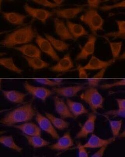 CREB3 Antibody - Azide and BSA Free, Novus Biologicals:Antibodies:Primary