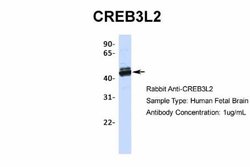 CREB3L2 Antibody, Novus Biologicals 100 &mu;L | Buy Online | Novus Biologicals | Fisher Scientific