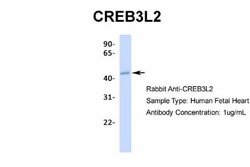 CREB3L2 Antibody, Novus Biologicals 100 &mu;L | Buy Online | Novus Biologicals | Fisher Scientific