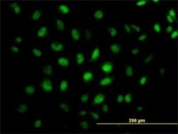 CREB5 Antibody (8A5), Novus Biologicals 0.1 mg | Buy Online | Novus Biologicals | Fisher Scientific