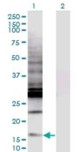 CREBL2 Antibody (1C1), Novus Biologicals 0.1 mg | Buy Online | Novus Biologicals | Fisher Scientific