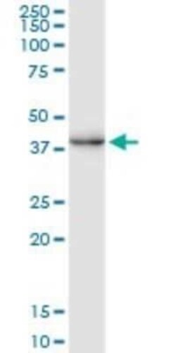 CREM Antibody (3B5), Novus Biologicals 0.1 mg | Buy Online | Novus Biologicals | Fisher Scientific
