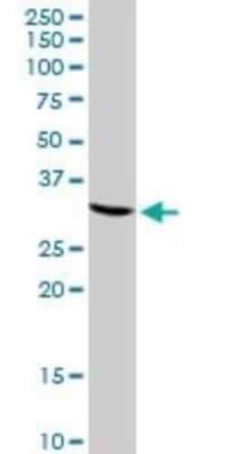 CREM Antibody, Novus Biologicals 0.1 mg | Buy Online | Novus Biologicals | Fisher Scientific