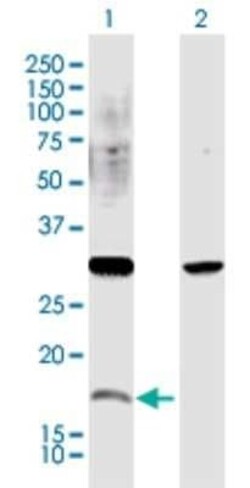 CREM Antibody, Novus Biologicals 0.1 mg | Buy Online | Novus Biologicals | Fisher Scientific