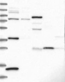 CRHBP Rabbit anti-Human, Polyclonal, Novus Biologicals 100 &mu;g; Unconjugated:Antibodies,