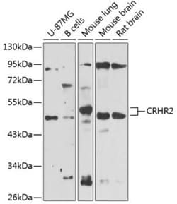 CRHR2/CRF2 Antibody - BSA Free, Novus Biologicals 0.1 mL, Unconjugated:Antikroppar