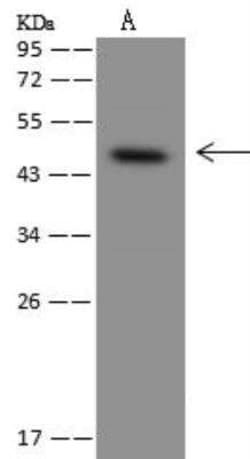 CRHR2/CRF2 Antibody, Novus Biologicals 100 &mu;g; Unconjugated:Antibodies,