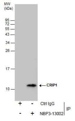 CRIP1 Antibody, Novus Biologicals 100 &mu;g | Buy Online | Novus Biologicals | Fisher Scientific