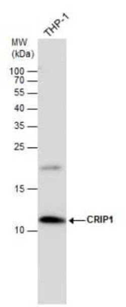 CRIP1 Antibody, Novus Biologicals 100 &mu;g | Buy Online | Novus Biologicals | Fisher Scientific