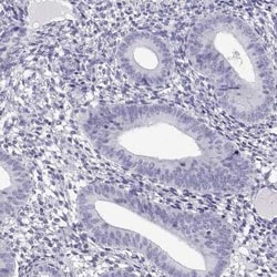 CRISP-1 Antibody, Novus Biologicals:Antibodies:Primary Antibodies