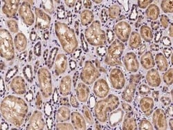 CRISPLD2 Antibody, Novus Biologicals 50 &mu;g | Buy Online | Novus Biologicals | Fisher Scientific