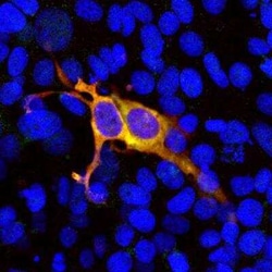 CRISPR-Cas9 Antibody, Novus Biologicals:Antibodies:Primary Antibodies