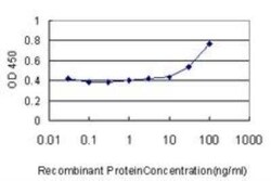 CRLF1 Antibody (4F4), Novus Biologicals 0.1 mg | Buy Online | Novus Biologicals | Fisher Scientific