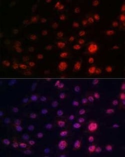 CRM1 Rabbit anti-Human, Mouse, Rat, Clone: 1J0L10, Novus Biologicals:Antibodies:Primary