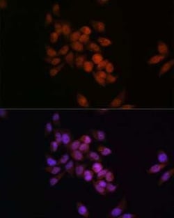 CRM1 Rabbit anti-Human, Mouse, Rat, Clone: 1J0L10, Novus Biologicals:Antibodies:Primary