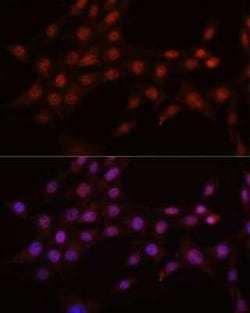 CRM1 Rabbit anti-Human, Mouse, Rat, Clone: 1J0L10, Novus Biologicals:Antibodies:Primary