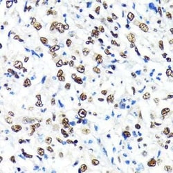 CRM1 Rabbit anti-Human, Mouse, Rat, Clone: 1J0L10, Novus Biologicals:Antibodies:Primary