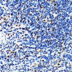 CRM1 Rabbit anti-Human, Mouse, Rat, Clone: 1J0L10, Novus Biologicals:Antibodies:Primary