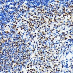 CRM1 Rabbit anti-Human, Mouse, Rat, Clone: 1J0L10, Novus Biologicals:Antibodies:Primary