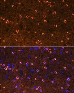 CRMP2 Rabbit anti-Human, Mouse, Rat, Clone: 0A1T1, Novus Biologicals:Antibodies:Primary