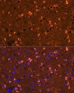 CRMP2 Rabbit anti-Human, Mouse, Rat, Clone: 0A1T1, Novus Biologicals:Antibodies:Primary