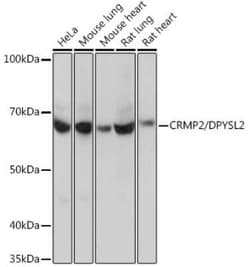 CRMP2 Rabbit anti-Human, Mouse, Rat, Clone: 0A1T1, Novus Biologicals:Antibodies:Primary