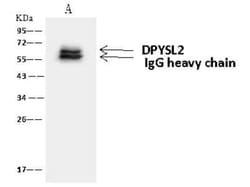 CRMP2 Antibody, Novus Biologicals:Antibodies:Primary Antibodies