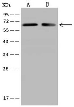 CRMP2 Antibody, Novus Biologicals:Antibodies:Primary Antibodies