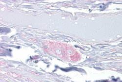 CRMP4 Antibody, Novus Biologicals 100 &mu;L; Unconjugated:Antibodies, Polyclonal